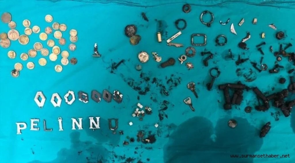 Midesinden 200'e yakın metal cisim çıkarılan hasta kurtarılamadı