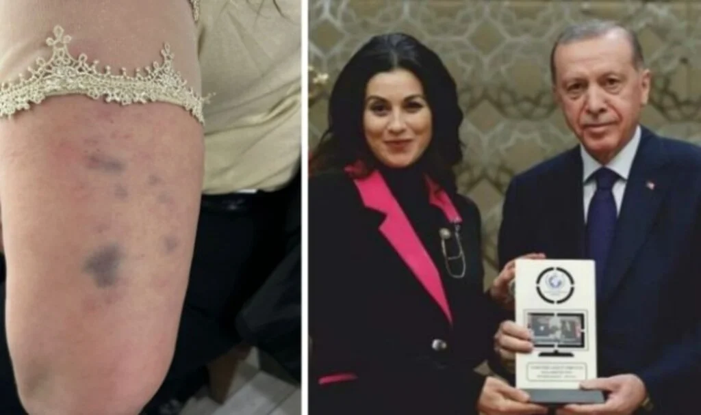 Kadın Gazeteciye Menfur Saldırı