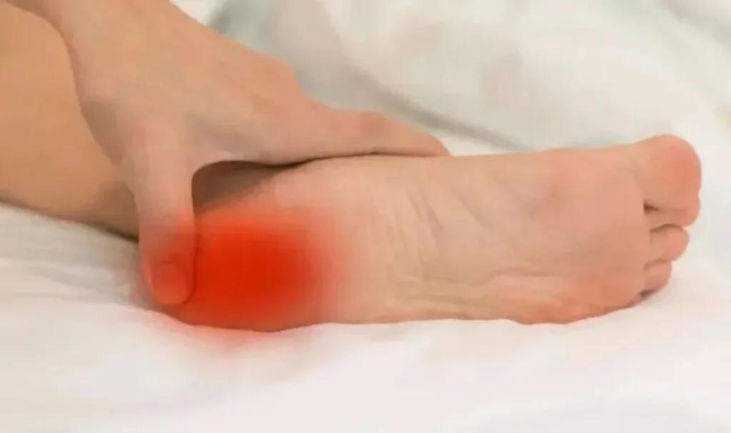 Ayağın Dış Yan Tarafında Ağrı Nasıl Geçer