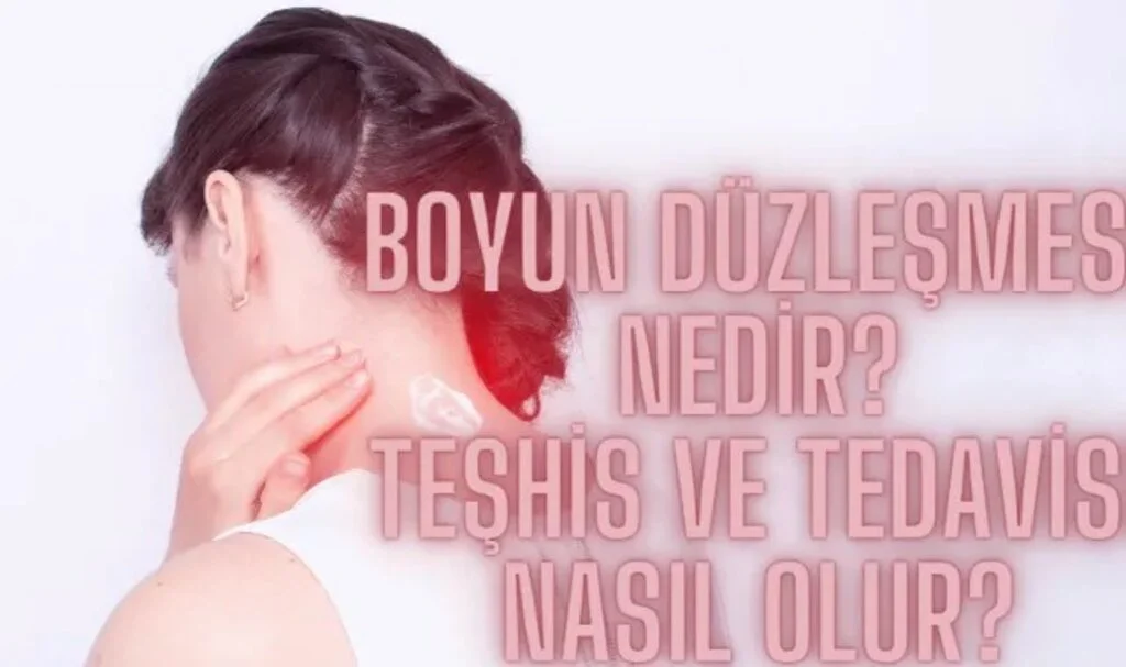 Boyun Düzleşmesi Evde Nasıl Tedavi Edilir
