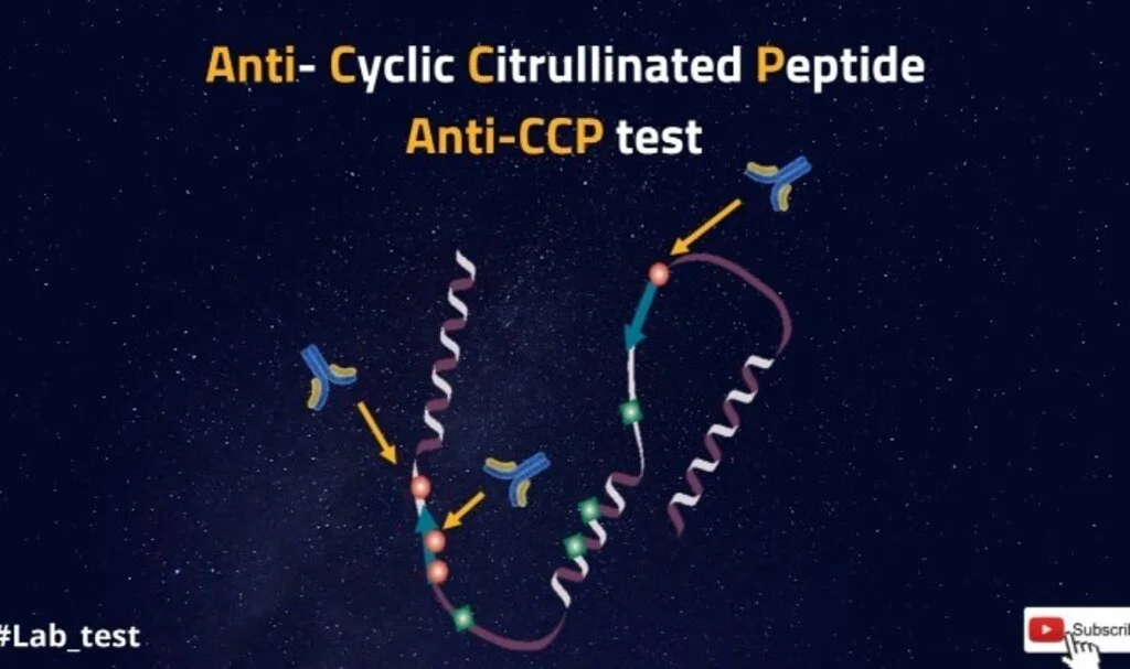 Cyclic Citrullinated Peptide (Ccp) Nedir