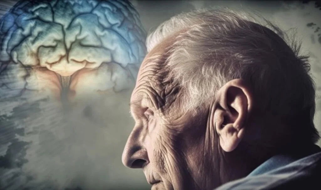 Alzheimer Hastalarının Ölümü Nasıl Olur