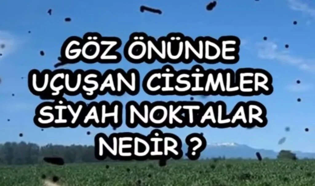  Gözde Uçuşan Siyah Noktalar Nasıl Geçer