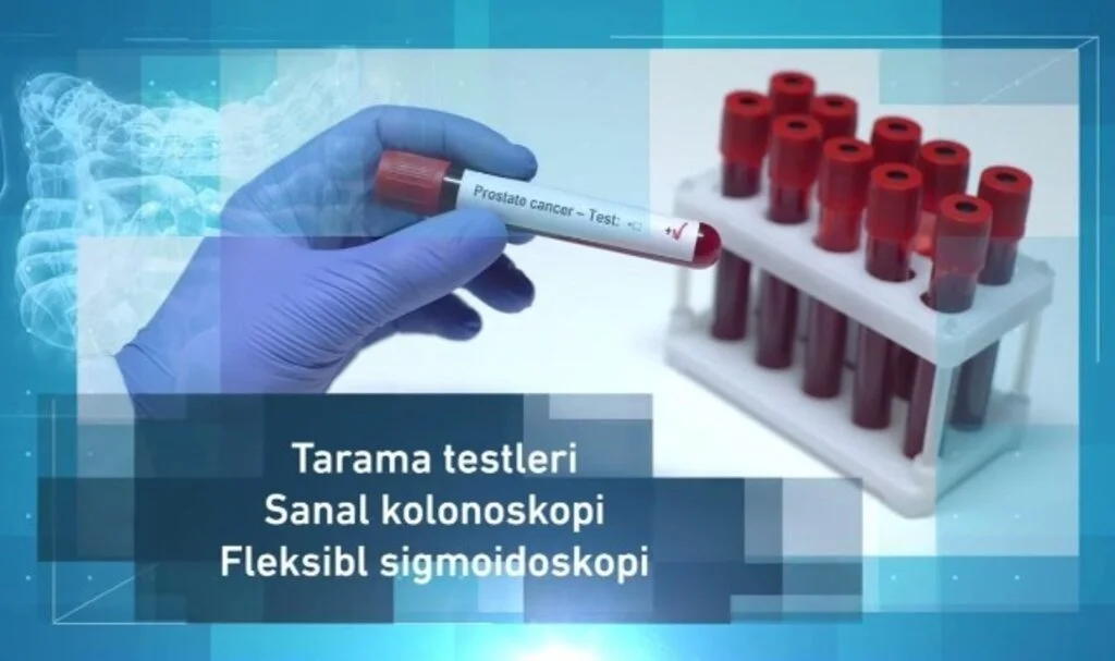 Kolon Kanseri Gaita Testi Çift Çizgi Nedir