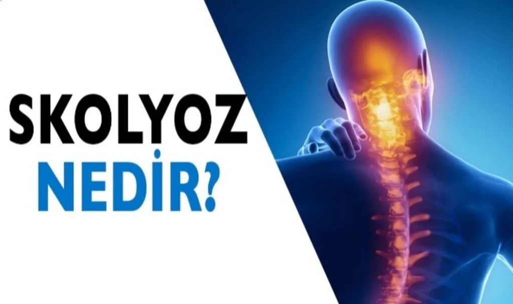 Skolyoz Nedir, Belirtileri