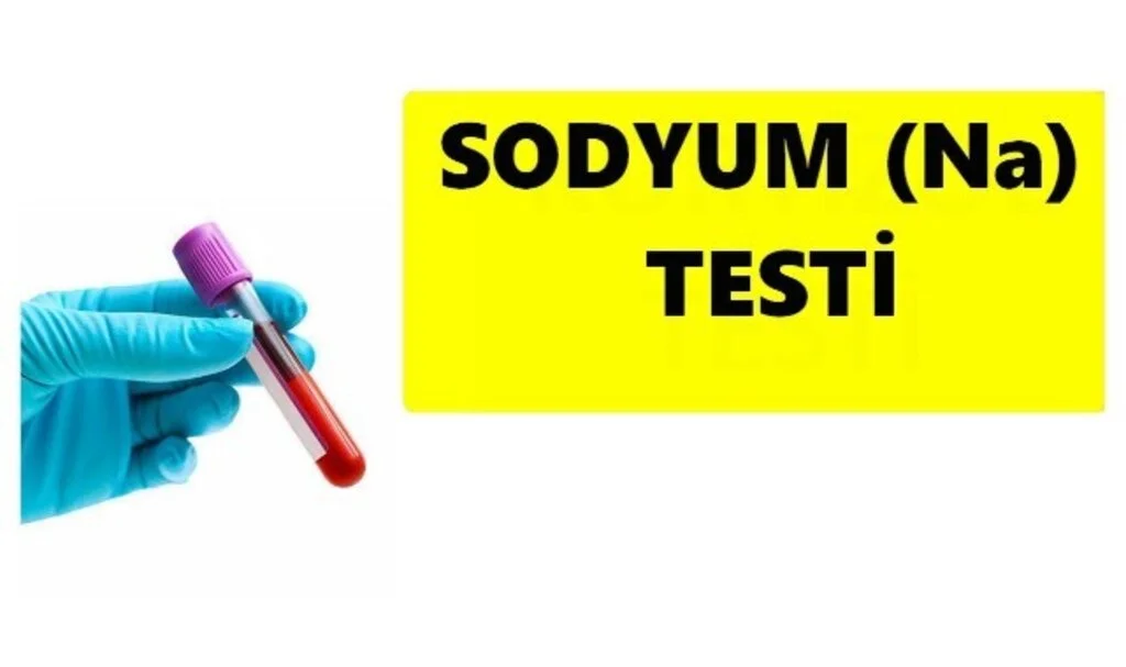 Sodyum Düşüklüğü Nasıl Tedavi Edilir.