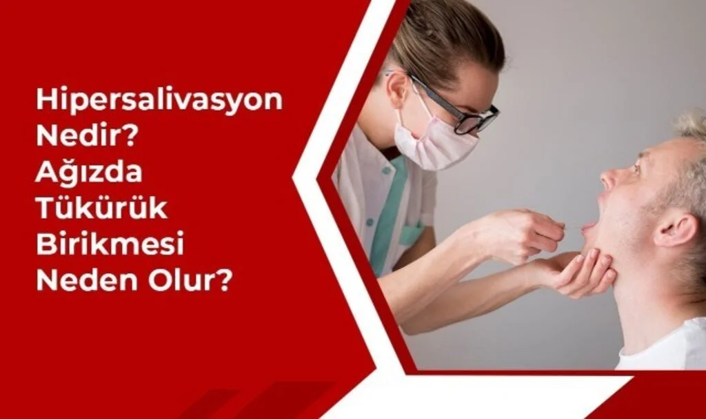 Ağızda Tükürük Birikmesi Nasıl Geçer