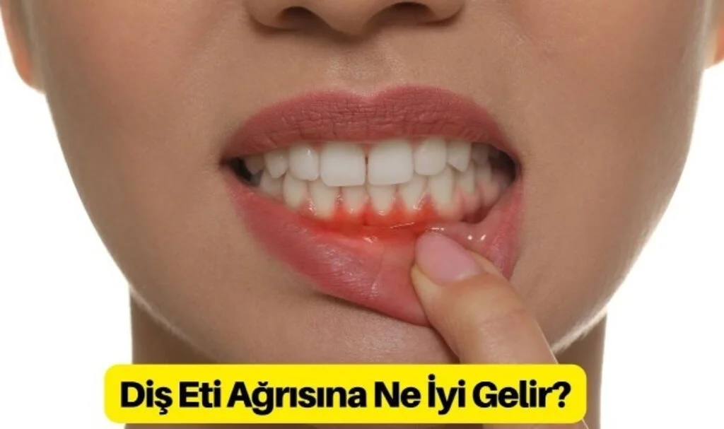 Diş Eti Ağrısı Nasıl Geçer Kesin Çözüm