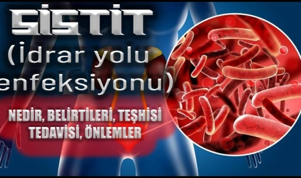 İdrar Yolu Enfeksiyonu Nasıl Anlaşılır