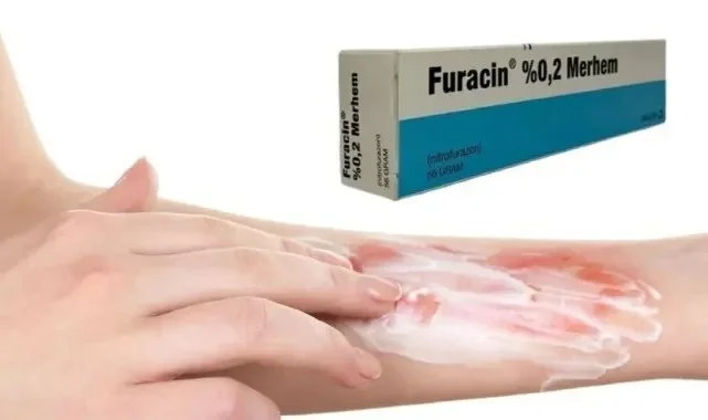Furacin 0 2 Merhem Ne İçin Kullanılır