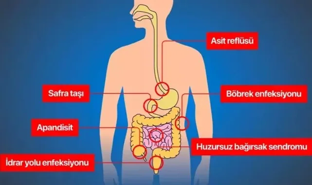 Karnın Sol Alt Tarafında Ağrı Nasıl Geçer