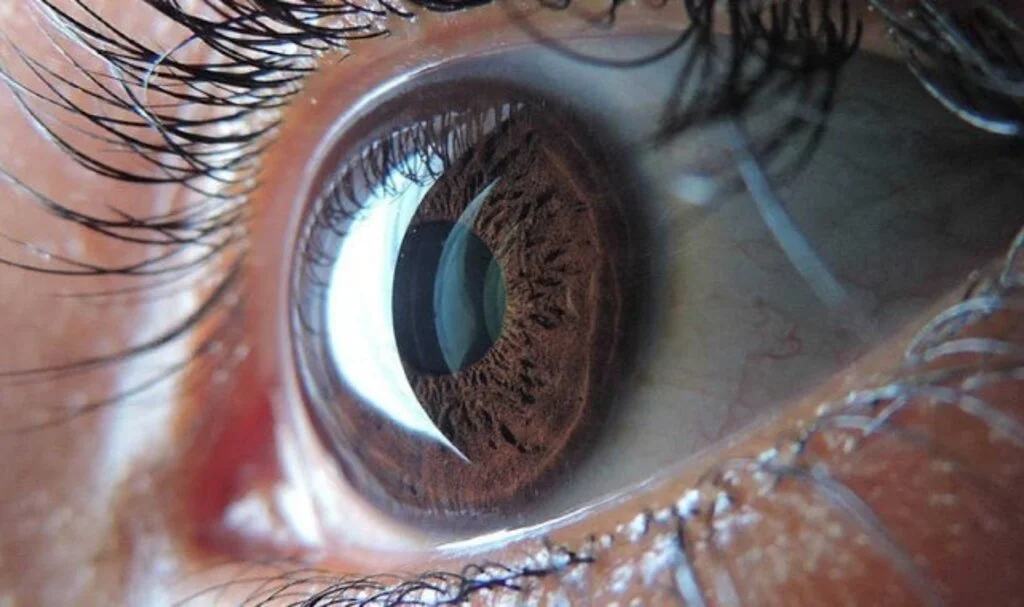 Göz Hastalıkları Retina Nedir