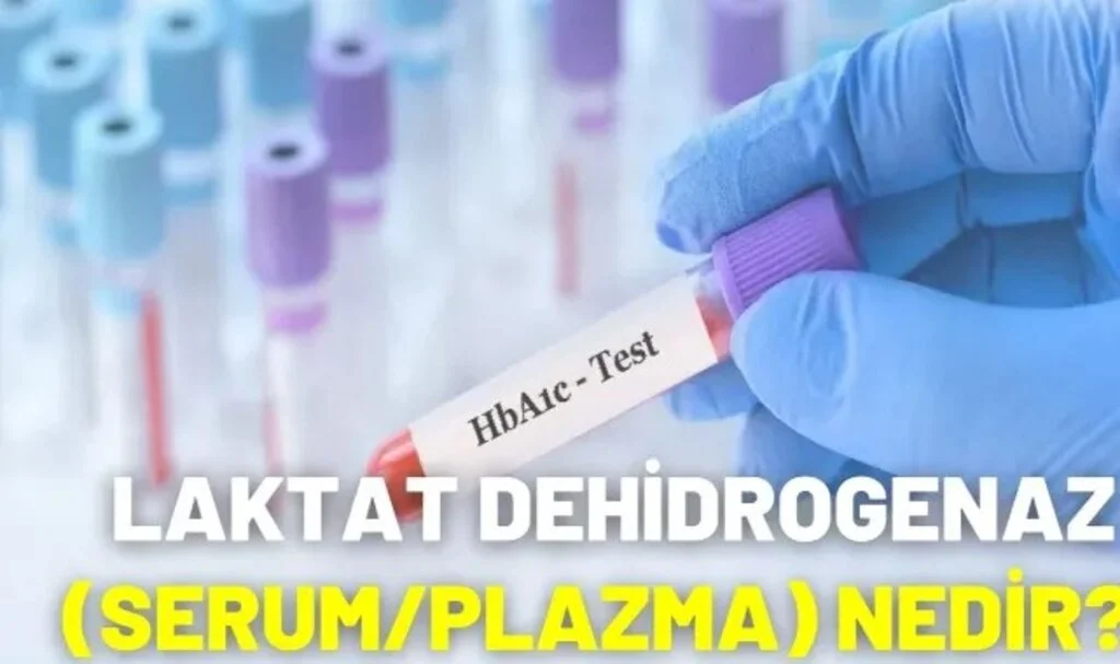 Laktat Dehidrogenaz (Serum/Plazma) Nedir