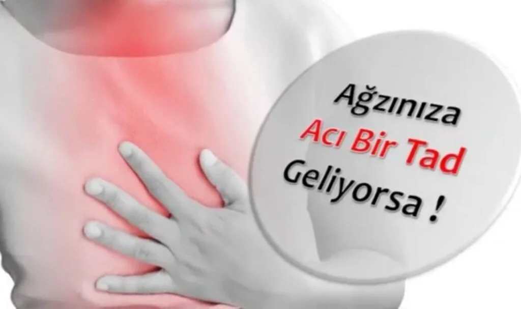 Mideden Ağza Acı Su Gelmesi Nasıl Geçer