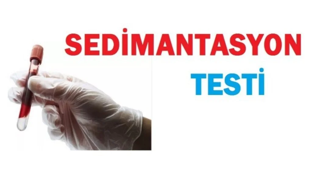 Sedimantasyon Yüksekliği Nasıl Düşürülür