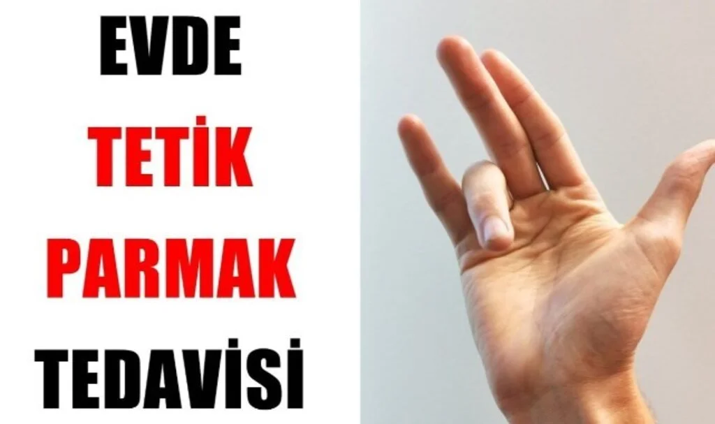 Tetik Parmak Evde Nasıl Tedavi Edilir